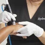 HYDRAFACIAL HAND TREATMENT