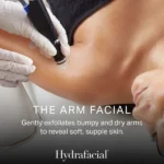 HYDRAFACIAL ARM TREATMENT