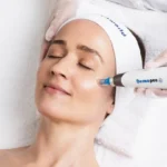 Dermapen 4 Skin Needling